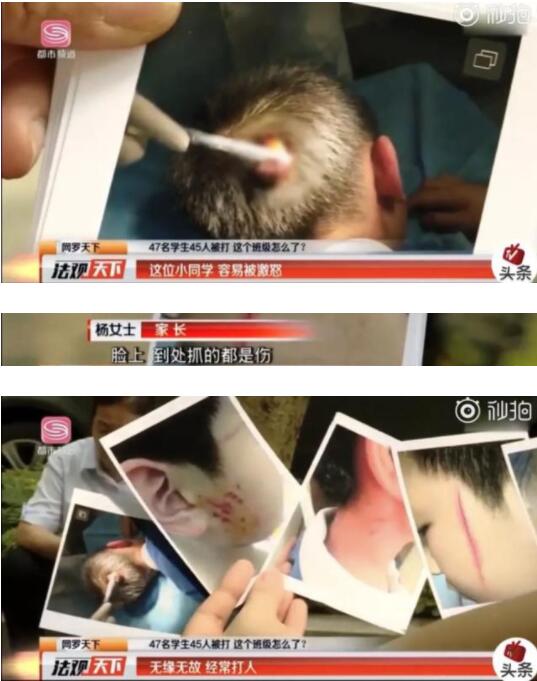 太气愤了！全班47名学生45人被打 家长回应只是“磕磕绊绊”